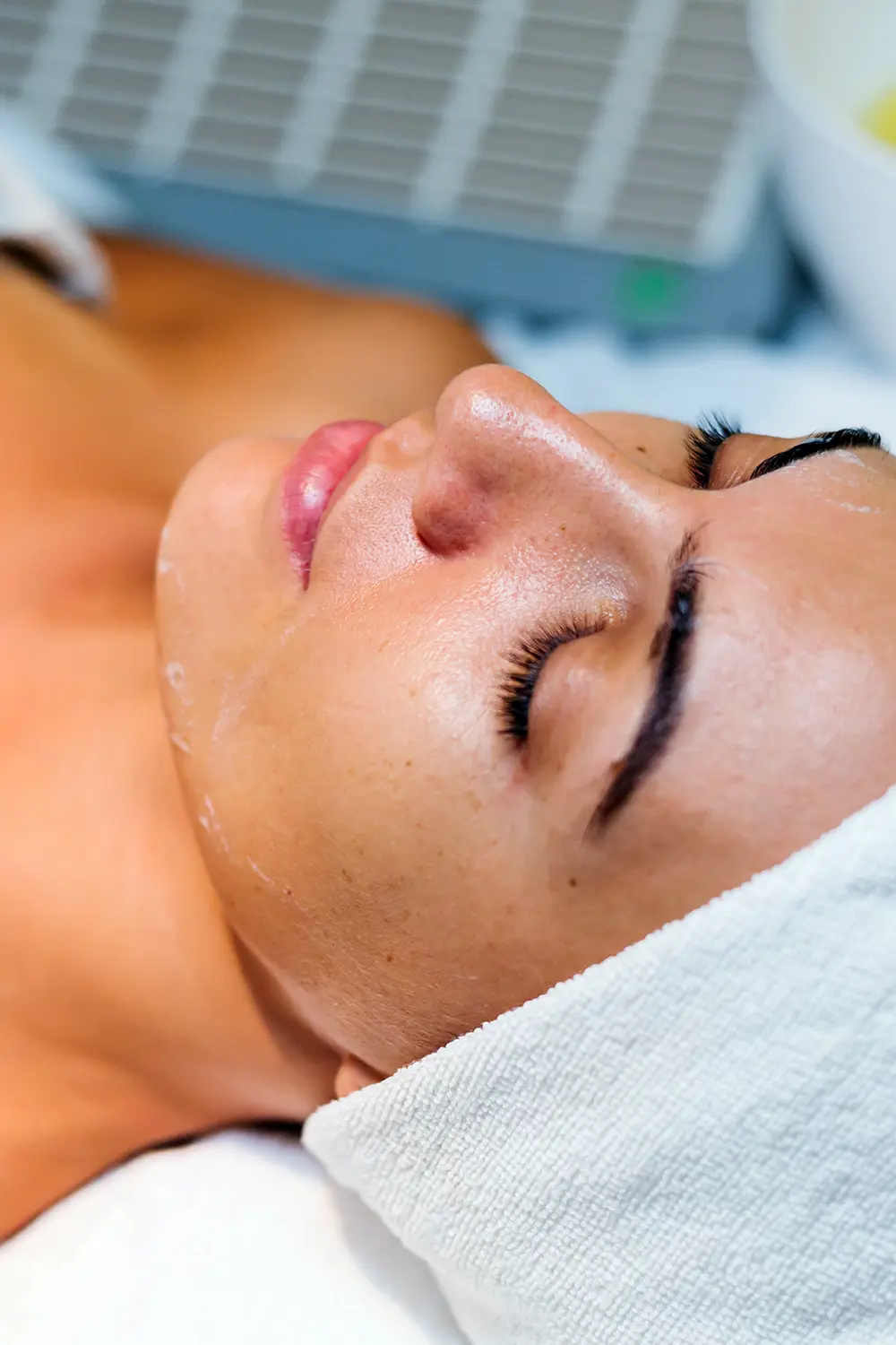 peeling-chimique peeling-chimique